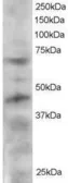 Anti-TRF1 antibody, C-term used in Western Blot (WB). GTX89932