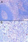 Anti-FOXP3 antibody, C-term used in IHC (Paraffin sections) (IHC-P). GTX89934
