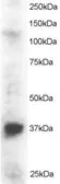 Anti-PINX1 antibody, N-term used in Western Blot (WB). GTX89938