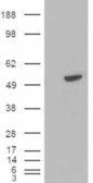 Anti-BLNK antibody, C-term used in Western Blot (WB). GTX89949