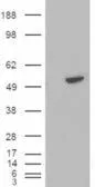 Anti-BLNK antibody, C-term used in Western Blot (WB). GTX89949