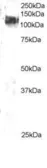 Anti-CBL antibody, C-term used in Western Blot (WB). GTX89954