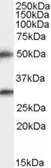 Anti-Spinesin antibody, C-term used in Western Blot (WB). GTX89957