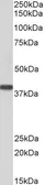 Anti-SET antibody, N-term used in Western Blot (WB). GTX89960