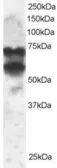 Anti-PPP2R5D antibody, C-term used in Western Blot (WB). GTX89966