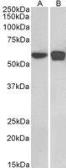 Anti-PLRG1 antibody, C-term used in Western Blot (WB). GTX89972
