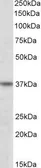 Anti-ATF4 antibody, C-term used in Western Blot (WB). GTX89973