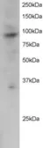 Anti-PRAM1 antibody, C-term used in Western Blot (WB). GTX89986