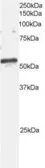 Anti-ARFGAP3 antibody, C-term used in Western Blot (WB). GTX89988
