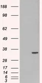 Anti-ORC6 antibody, C-term used in Western Blot (WB). GTX89996
