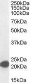 Anti-MAX antibody, C-term used in Western Blot (WB). GTX89997