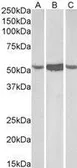 Anti-ALDH1A1 antibody, C-term used in Western Blot (WB). GTX90658