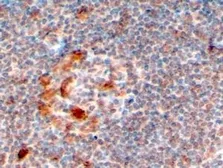 Anti-ZCCHC11 antibody, C-term used in IHC (Paraffin sections) (IHC-P). GTX94119