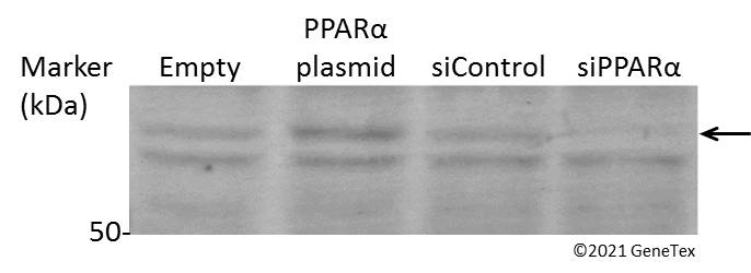 Anti-PPAR alpha antibody (GTX101098) | GeneTex