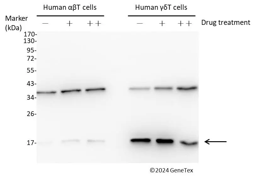 Anti-CD3 zeta antibody [C1C3] (GTX108479) | GeneTex