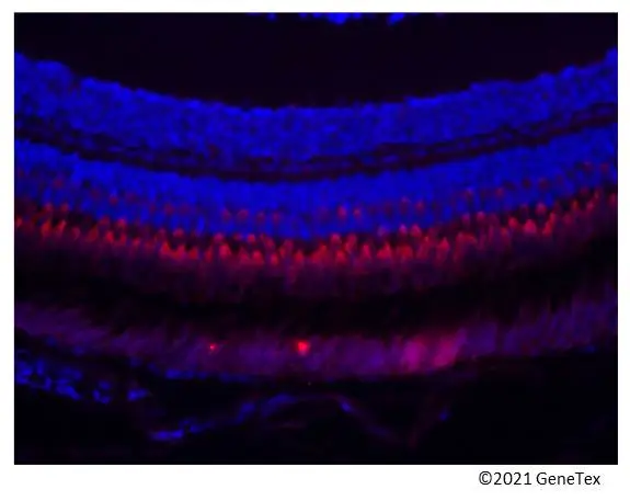 Anti-ZNF259 antibody [N3C3] (GTX109364) | GeneTex