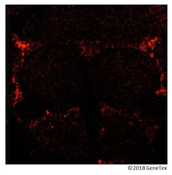 Anti-GABA antibody (GTX125988) | GeneTex Anti-GABA antibody (GTX125988) | GeneTex