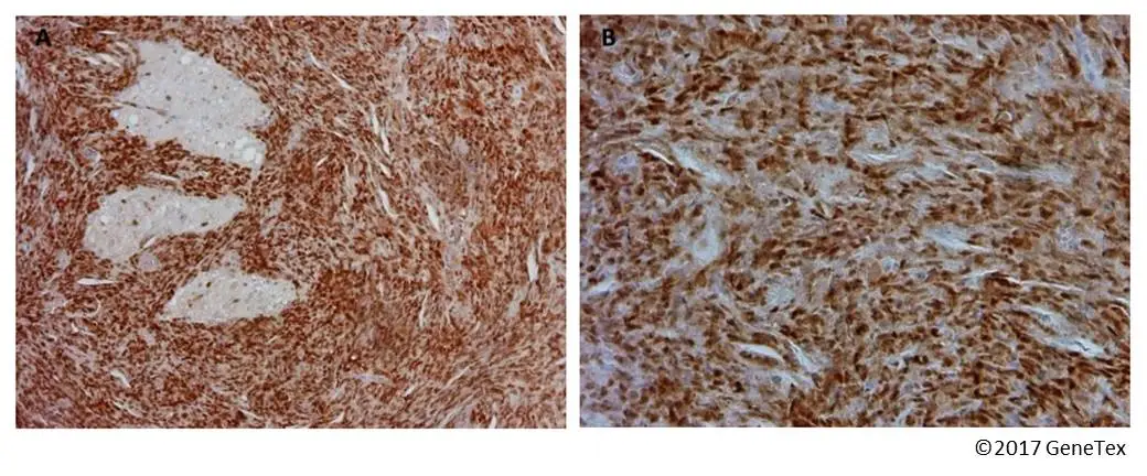同胞 Anti-p53 antibody (GTX128135) | GeneTex