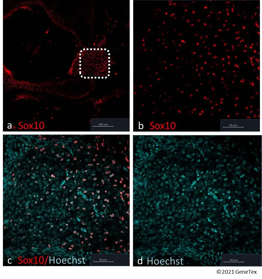 Anti-Sox10 antibody (GTX128374) | GeneTex