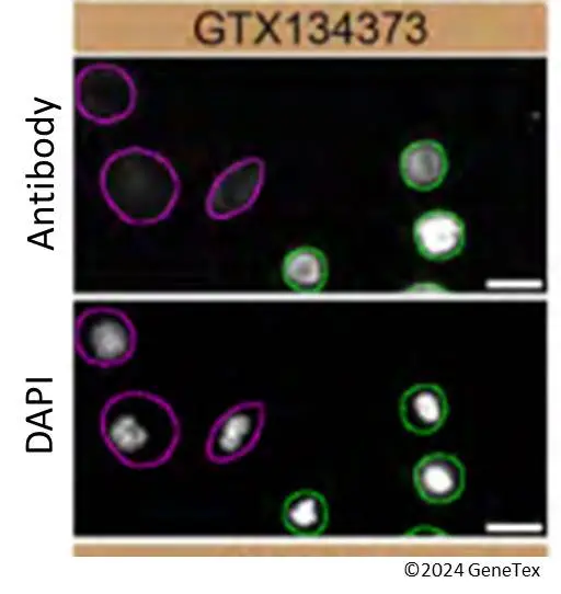 Anti-STING antibody (GTX134373) | GeneTex
