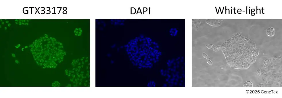 Anti-ELF5 antibody (GTX33178) | GeneTex
