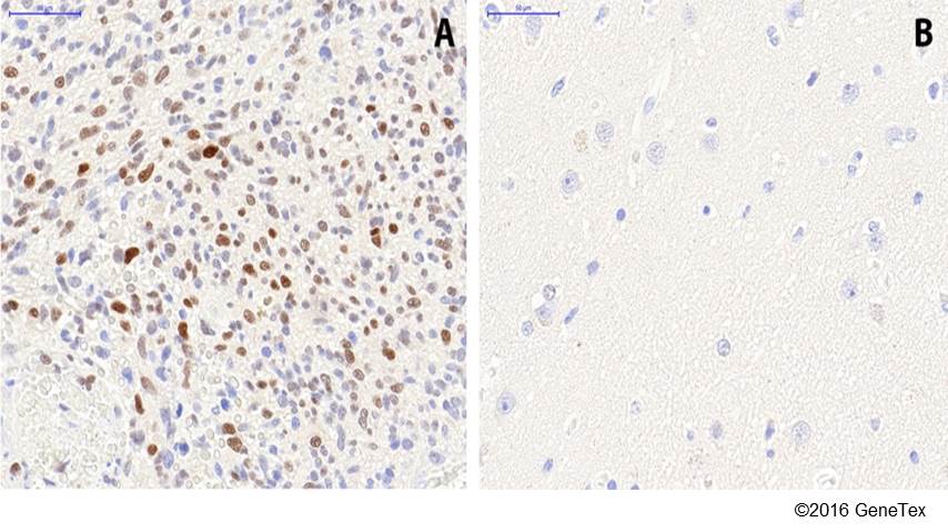 Anti Hif1 Alpha Antibody Gt10211 Gtx628480 Genetex