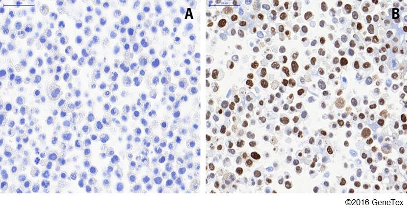 Anti Hif1 Alpha Antibody Gt10211 Gtx628480 Genetex
