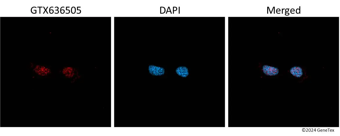 Anti-SOX2 antibody [HL1193] (GTX636505) | GeneTex