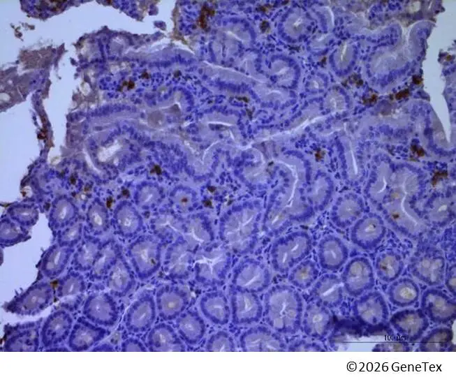 Anti-MUC2 antibody [HL1724] (GTX637372) | GeneTex
