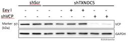 Anti-VCP antibody used in Western Blot (WB). GTX101089