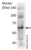 Anti-PINK1 antibody [N3C3] used in Western Blot (WB). GTX107851