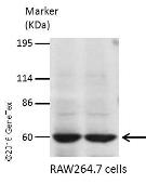Anti-PIP5K1A antibody [N1N3] used in Western Blot (WB). GTX111953
