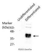 Anti-CDX2 antibody used in Western Blot (WB). GTX113160