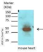Anti-GATA4 antibody used in Western Blot (WB). GTX113194