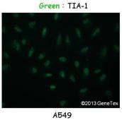 Anti-TIA1 antibody [N1N3] used in Immunocytochemistry/ Immunofluorescence (ICC/IF). GTX113280