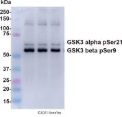 Anti-GSK3 alpha (phospho Ser21) + GSK3 beta (phospho Ser9) antibody used in Western Blot (WB). GTX132997